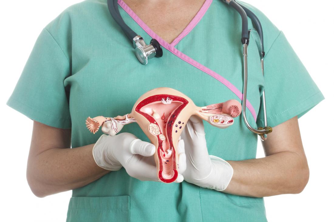 Hysterectomy treatment