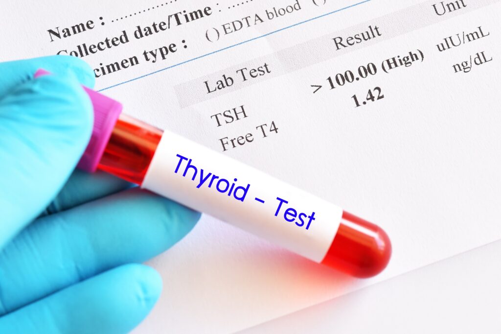 Thyroid Function Tests Market